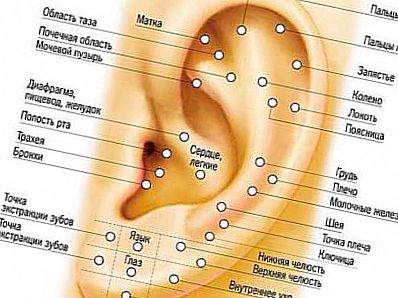Проколювання вуха
